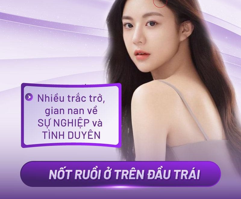 nốt ruồi trên đầu trong tóc nốt ruồi trên đầu trong tóc