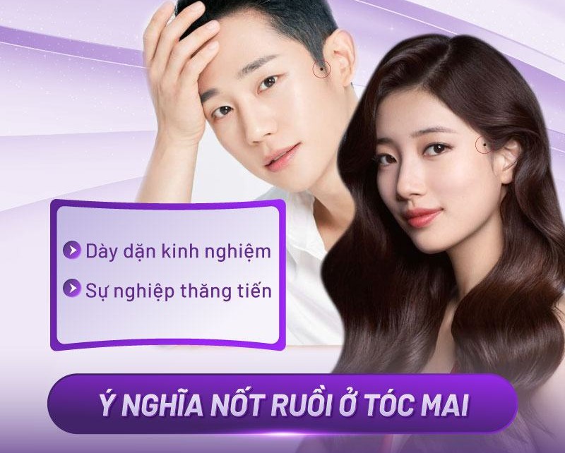 nốt ruồi trên đỉnh đầu nốt ruồi trên đỉnh đầu