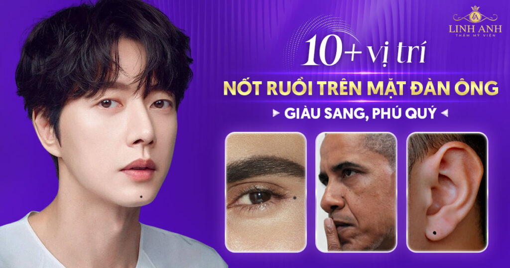 nốt ruồi trên mặt đàn ông giàu sang