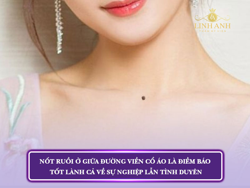 nốt ruồi trên ngực nam