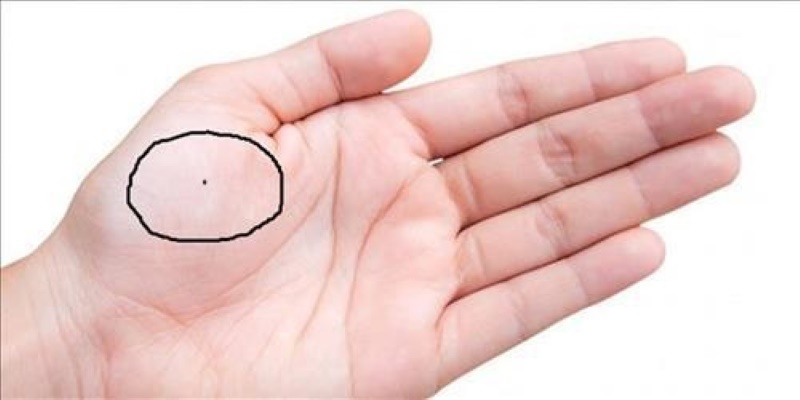 Nốt ruồi trong lòng bàn ở gò Kim Tinh