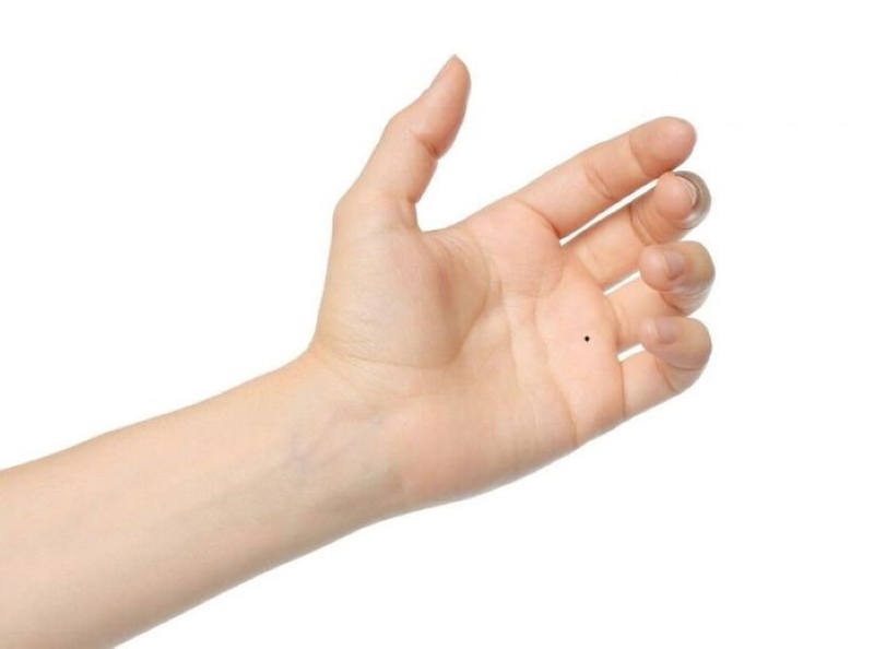 Nốt ruồi trong lòng bàn tay trái nữ
