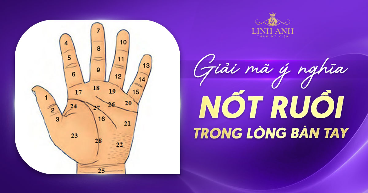 Nốt ruồi trong lòng bàn tay trái, phải của Nam, Nữ nói lên điều gì?