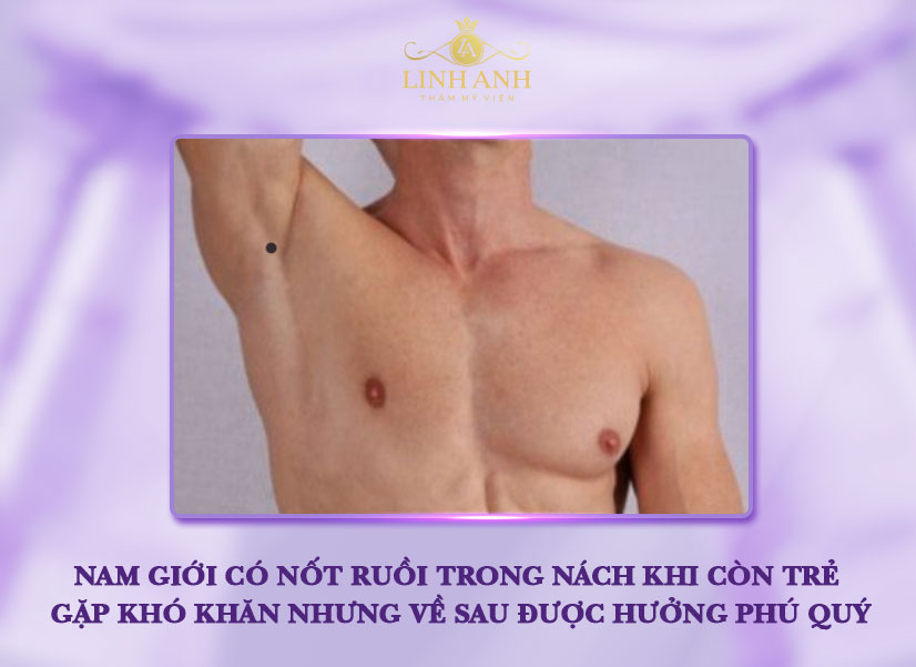 Nốt ruồi trong nách