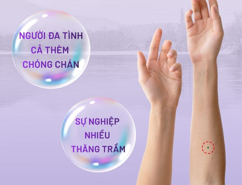 Nốt ruồi xanh ở cánh tay