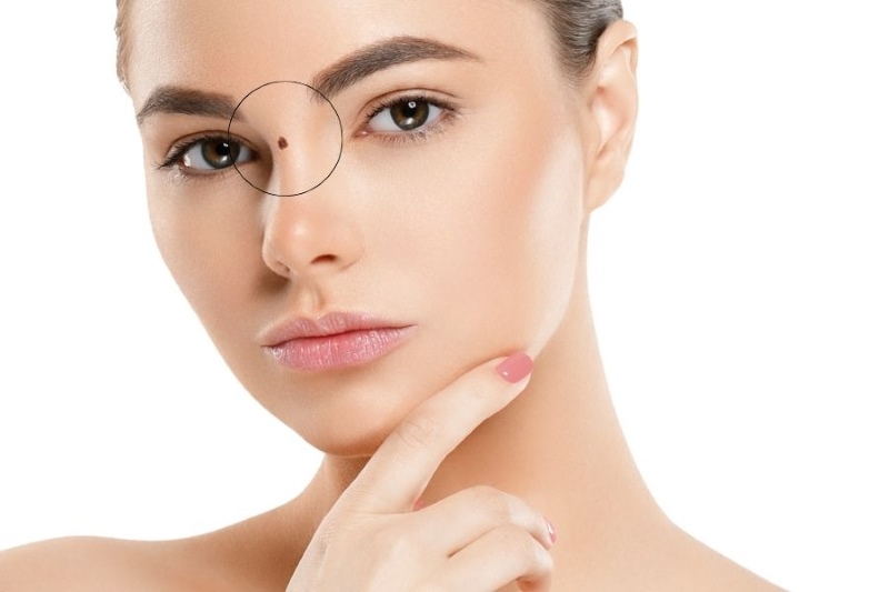 nốt ruồi xui xẻo trên mặt nữ