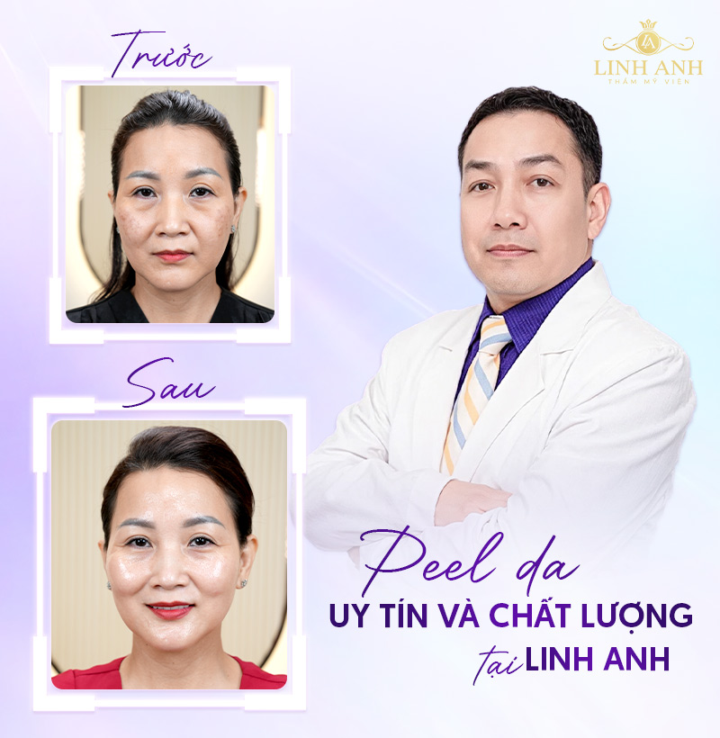 peel da hóa học