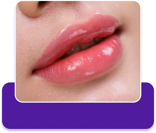 Dịch vụ phun môi collagen