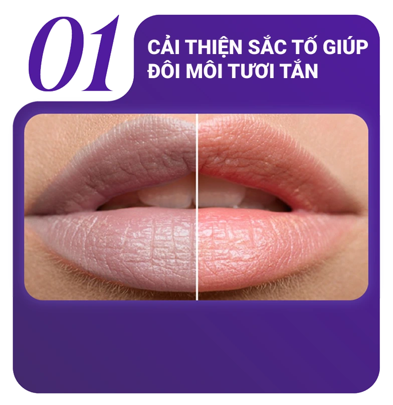 Đối tượng nên phun và cấy môi