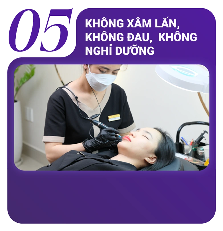 Đối tượng nên phun và cấy môi