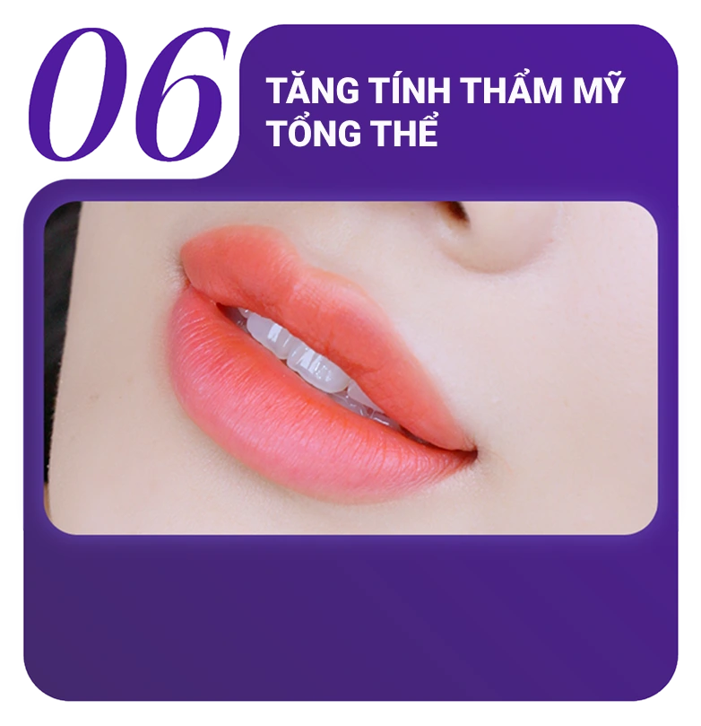 Đối tượng nên phun và cấy môi
