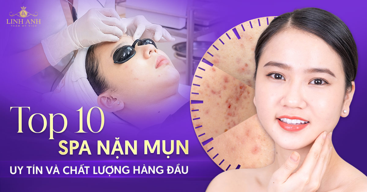 spa nặn mụn