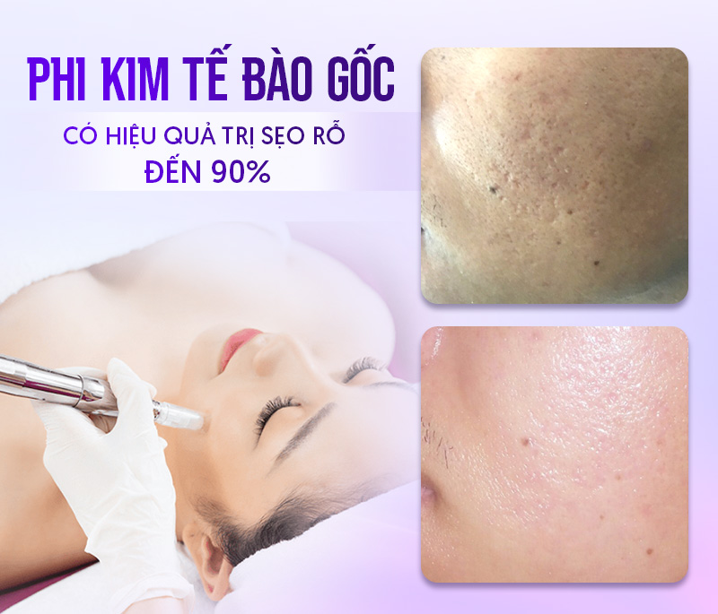 tác dụng của Phi kim