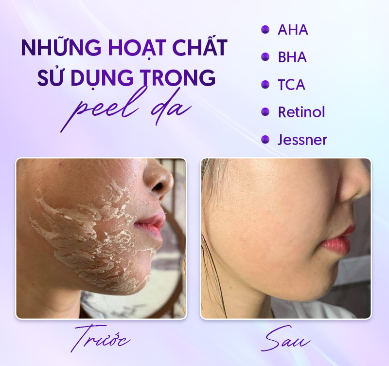 tác dụng của peel da