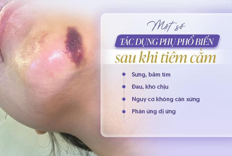 Tác dụng phụ của tiêm filler cằm