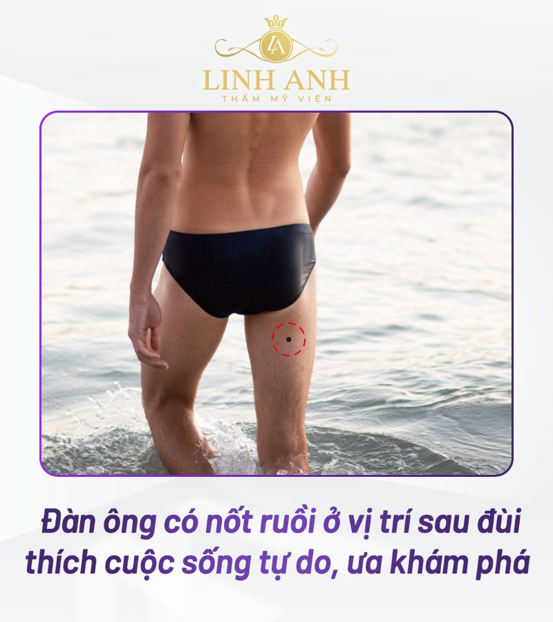 tẩy nốt ruồi ở đùi