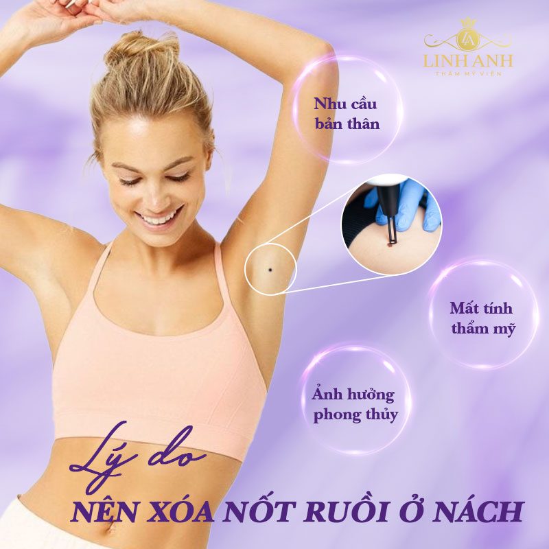 Tẩy nốt ruồi ở nách