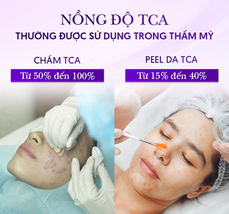 TCA chấm sẹo rỗ nồng độ bao nhiêu