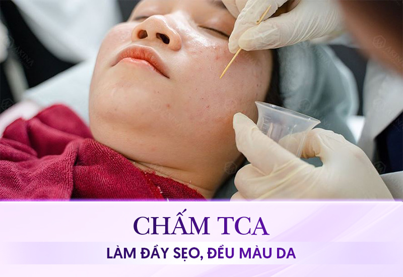 TCA có tác dụng gì