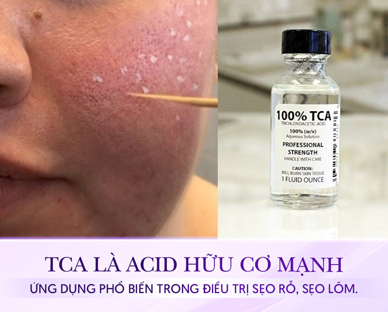 TCA là chất gì