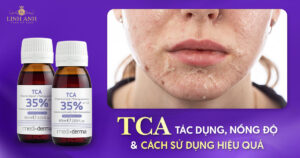 TCA là gì