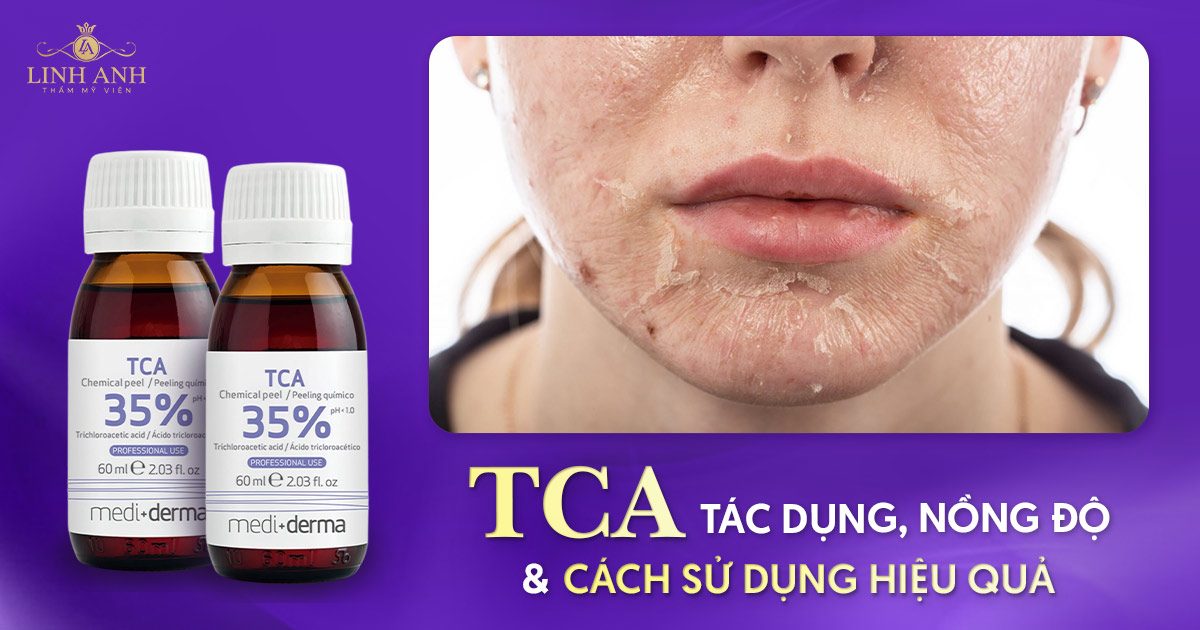 TCA là gì? Tác dụng, nồng độ & cách sử dụng hiệu quả