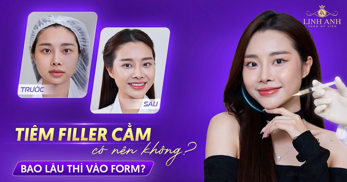 Tiêm filler cằm có ảnh hưởng gì không? Những điều cần biết