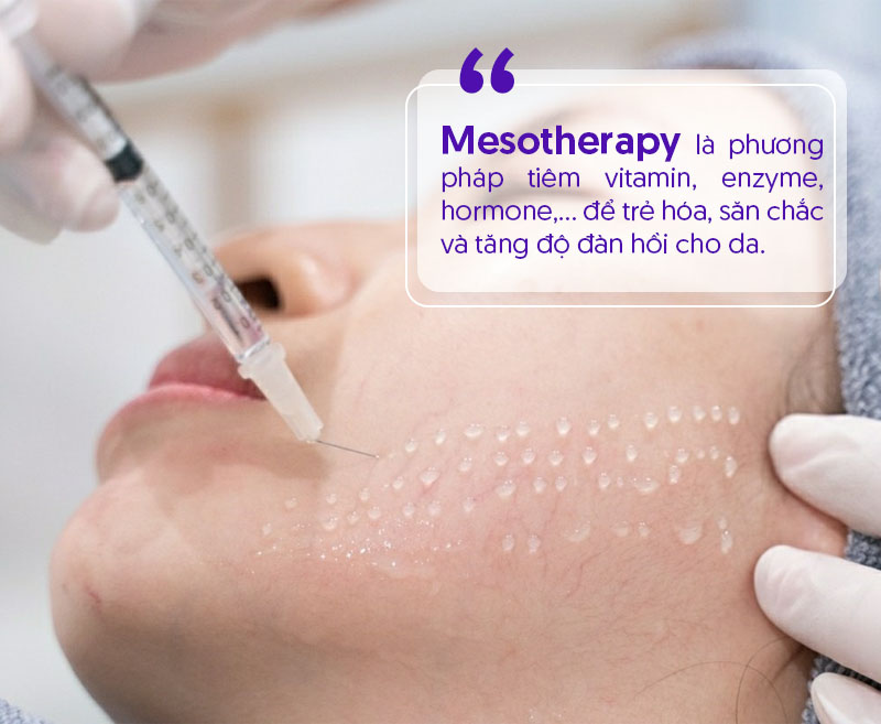 Tiêm Mesotherapy là gì