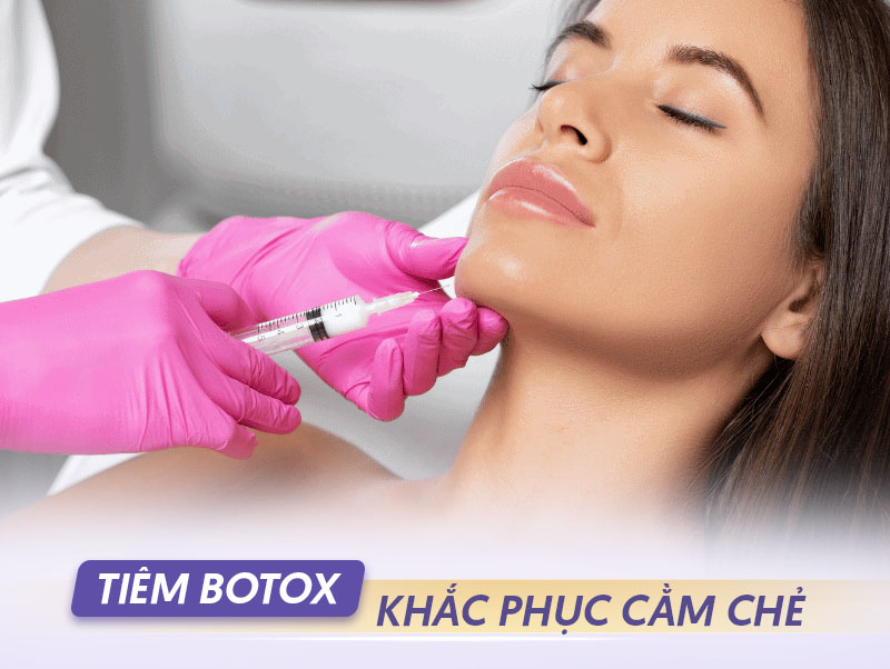 Tiêm botox khắc phục cằm chẻ