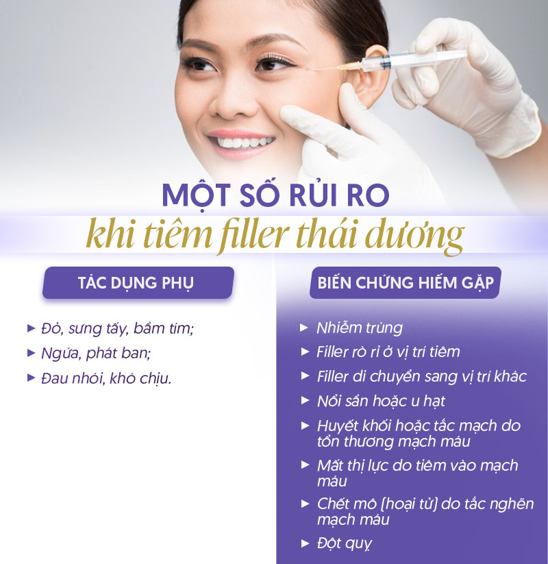 Tiêm filler thái dương bao lâu hết sưng