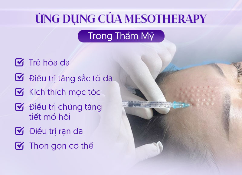 Tiêm Mesotherapy có tác dụng gì