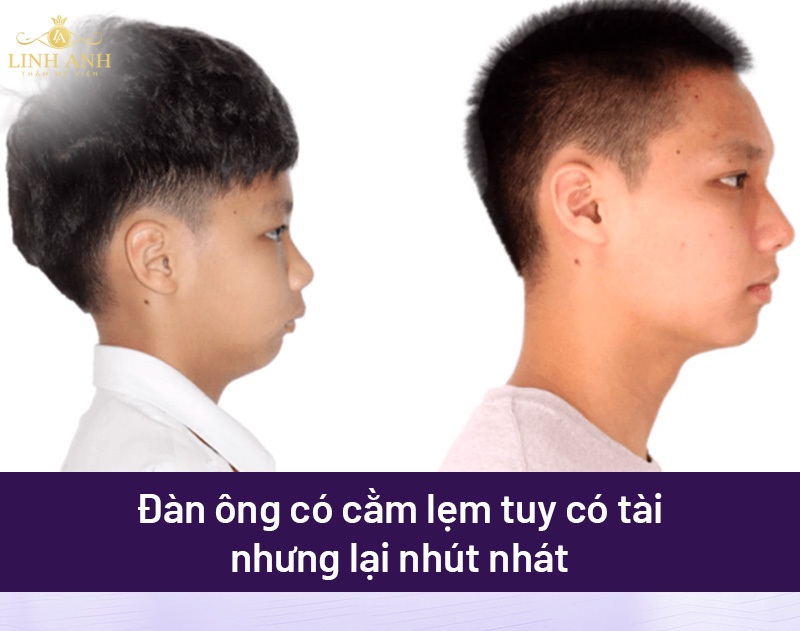 Cằm lẹm tướng số