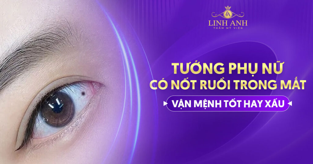 Tướng phụ nữ có nốt ruồi trong mắt