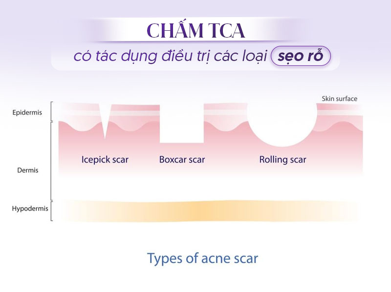 ứng dụng của TCA trong thẩm mỹ da