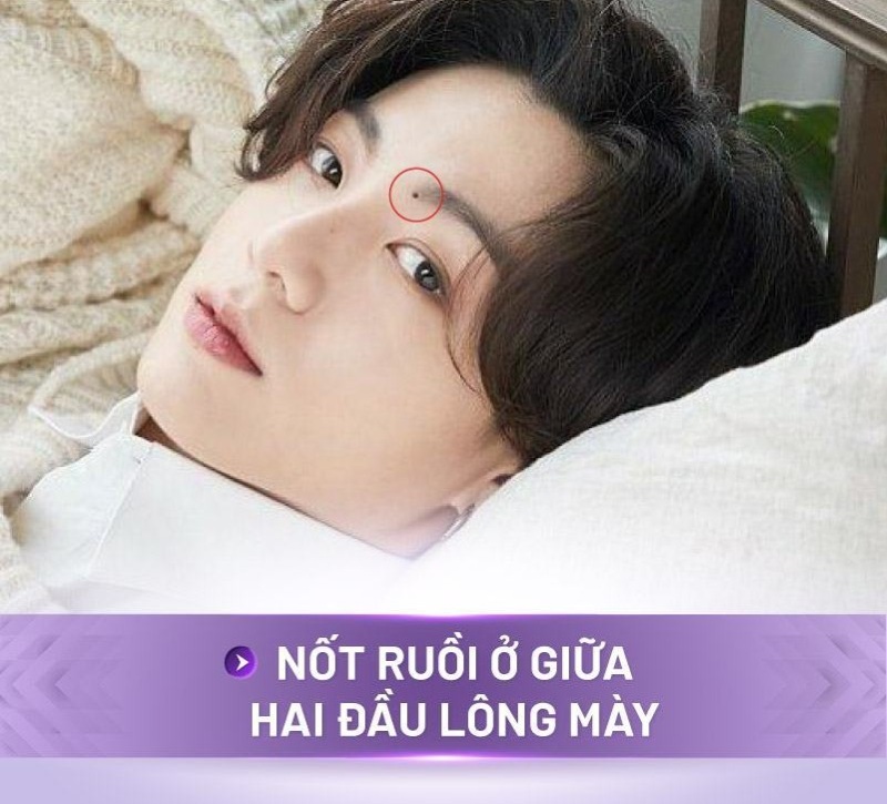 Vị trí nốt ruồi trên mặt bạn không nên tẩy