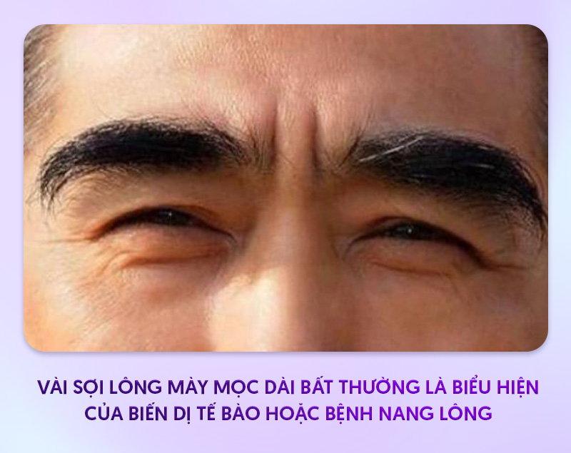 lông mày dài hơn mắt