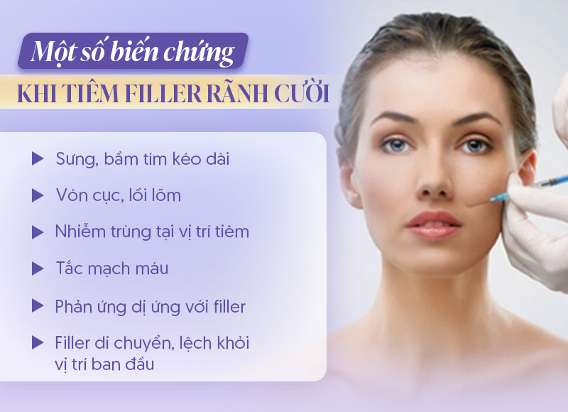 Biến chứng tiêm filler rãnh cười