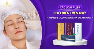 Các loại filler được bộ y tế cấp phép