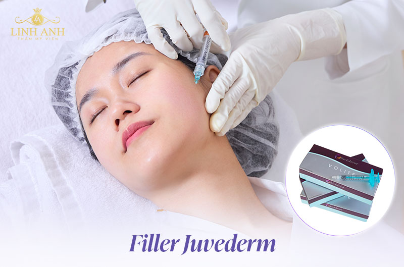 Các loại filler và giá