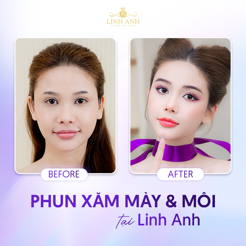 các thẩm mỹ viện uy tín tại tphcm