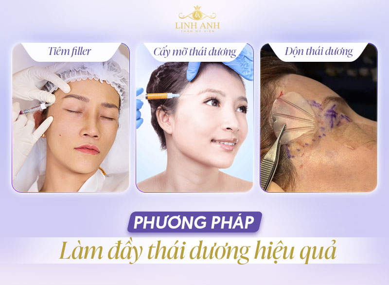 Cách làm đầy thái dương hiệu quả