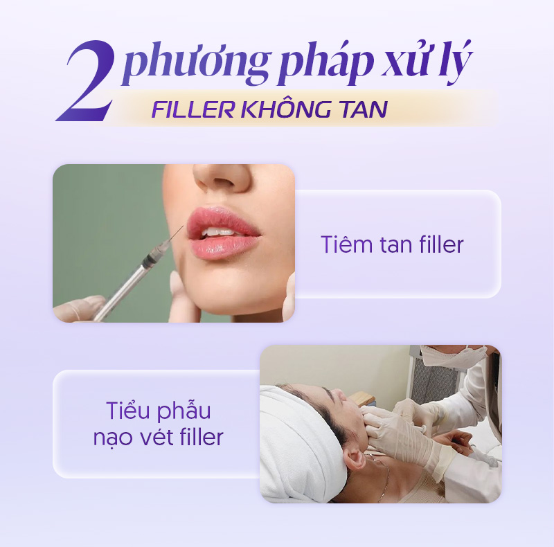 Cách làm filler tan nhanh