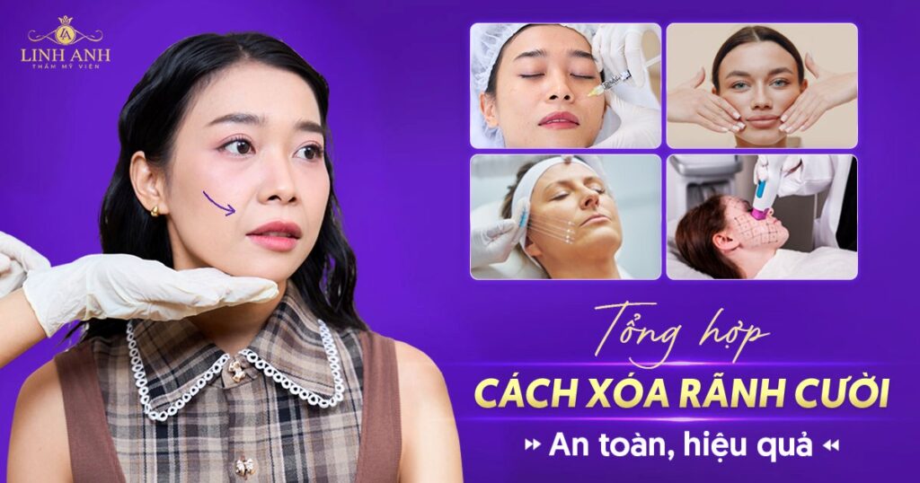 Cách xoá rãnh cười