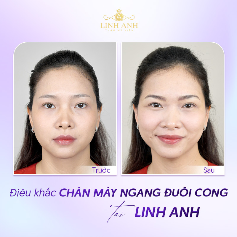 chân mày ngang