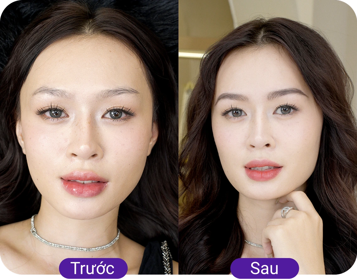 Chị Thảo Nhi (30 tuổi)