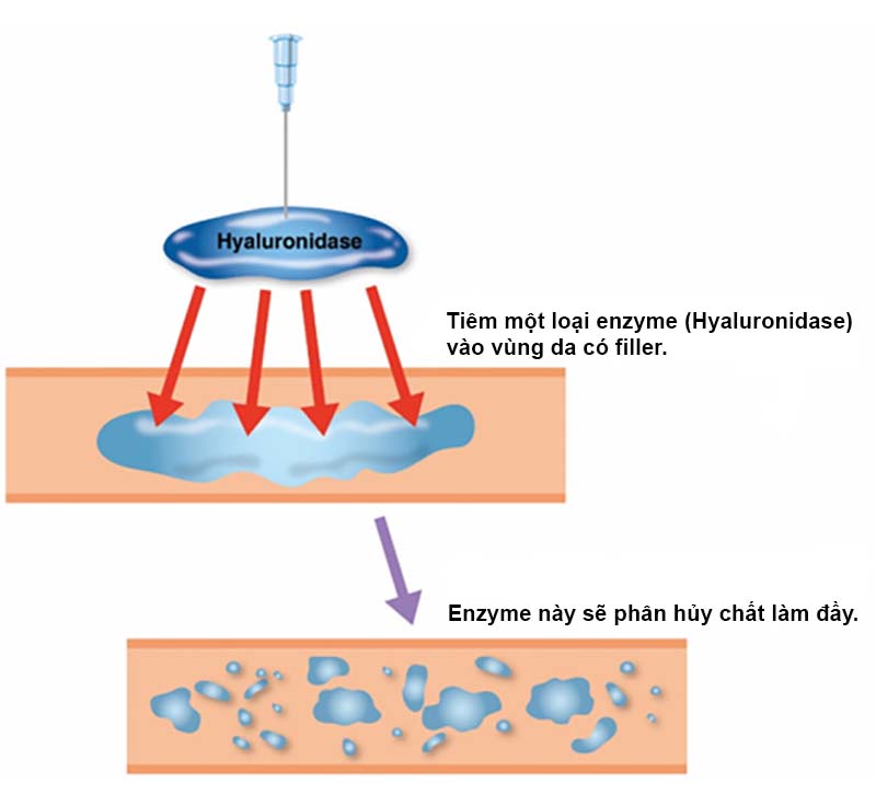 Cơ chế hoạt động của chất tiêm tan filler
