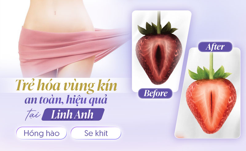 Địa chỉ tiêm filler vùng kín