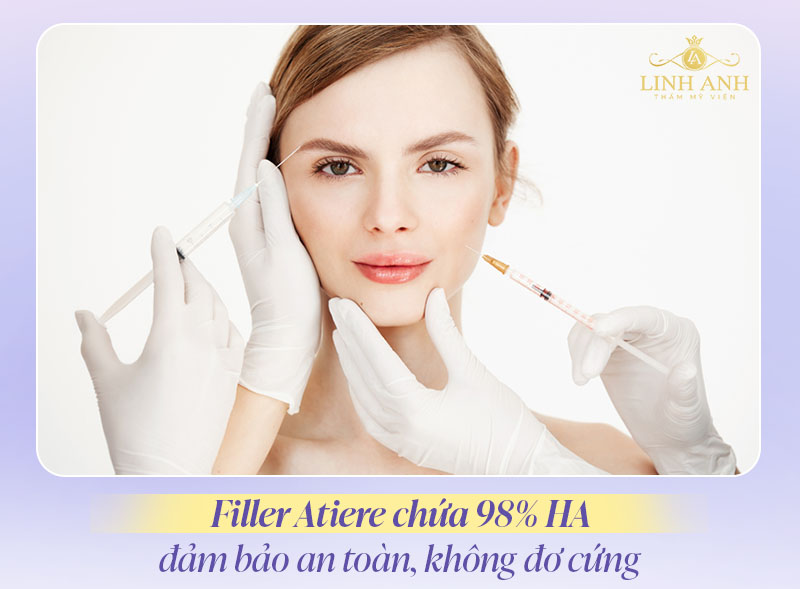 Filler Atiere có tốt không