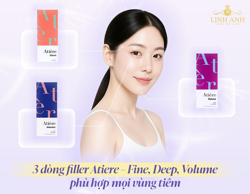 Filler Atiere giữ được bao lâu