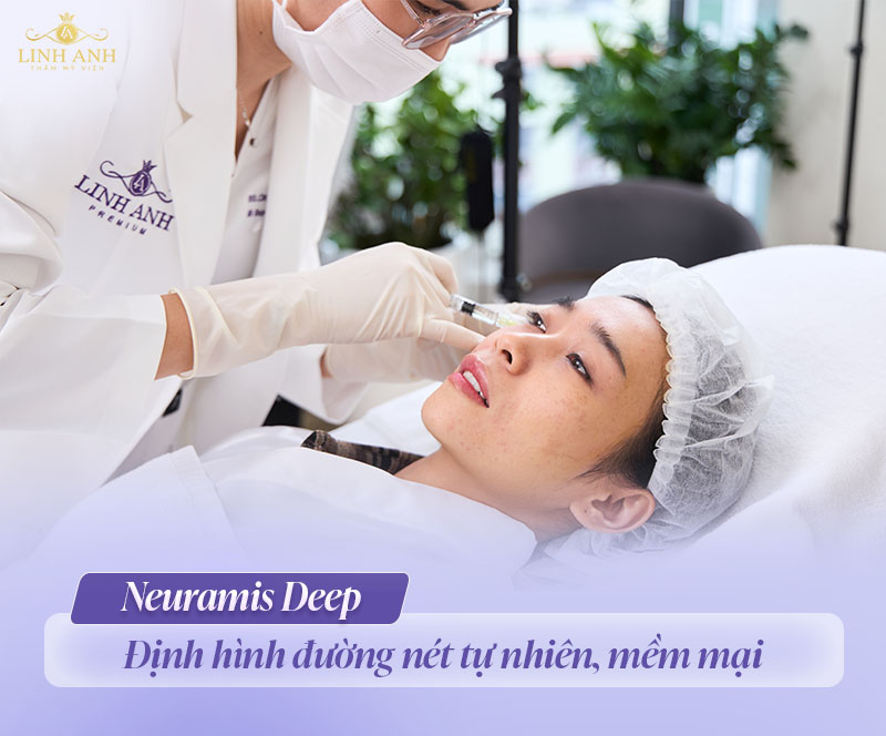 Filler neuramis có tốt không